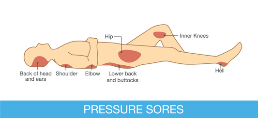 The Benefits of Pressure Redistributing Foam